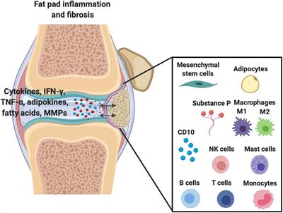 Infrapatellar Fat Pad/Synovium Complex in Early-Stage Knee Osteoarthritis: Potential New Target and Source of Therapeutic Mesenchymal Stem/Stromal Cells